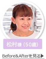 松村様のBEFORE＆AFTERを見る