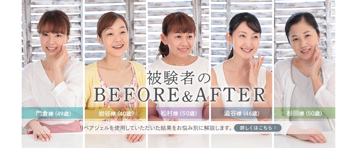被験者のBEFORE＆AFTER。製品を使用していただいた結果をお悩み別に解説します。